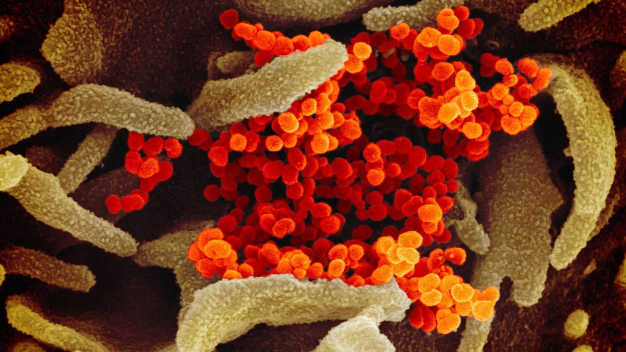 Photo of the coronavirus under a microscope