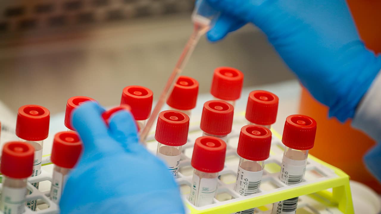 Photo of coronavirus patient samples