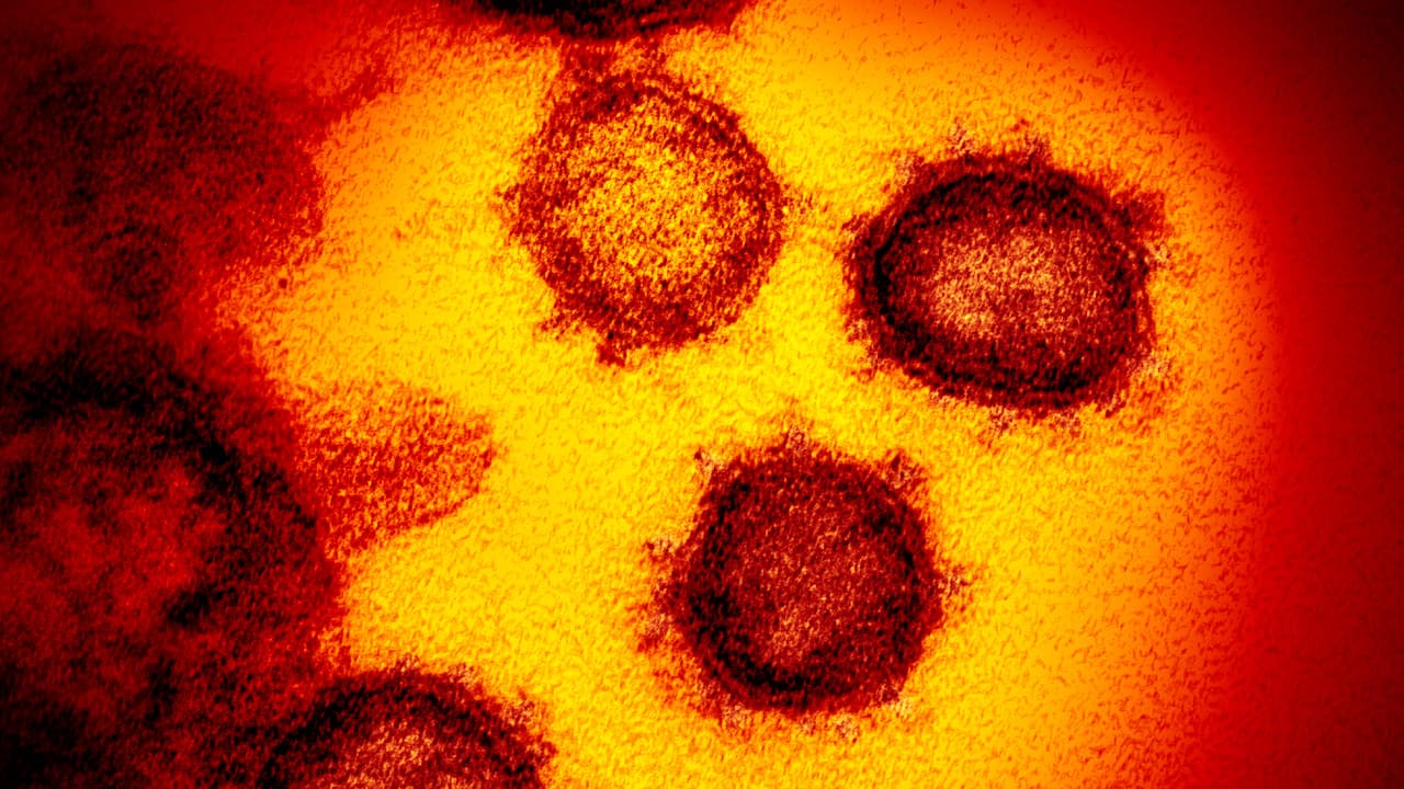 Photo of a close up of SARS-CoV-2