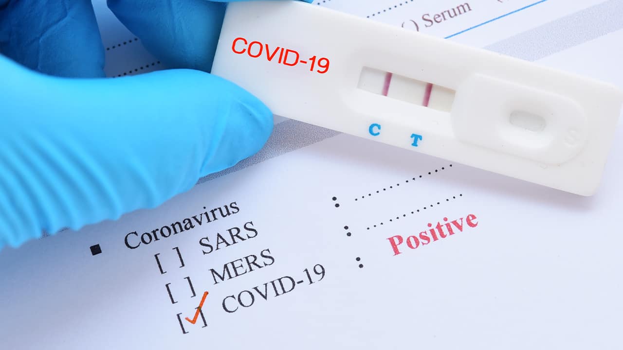 Photo of test sample marked positive for the coronavirus