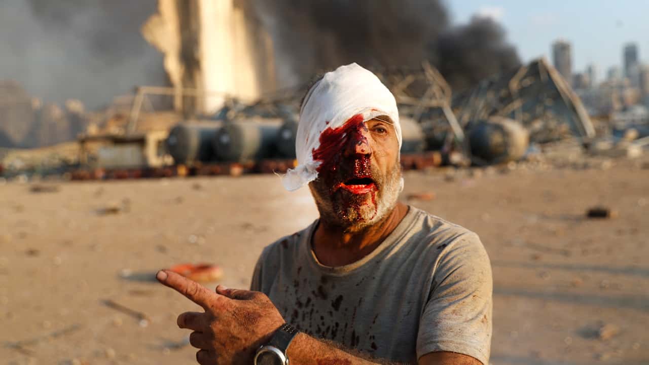 Photo of an injured man