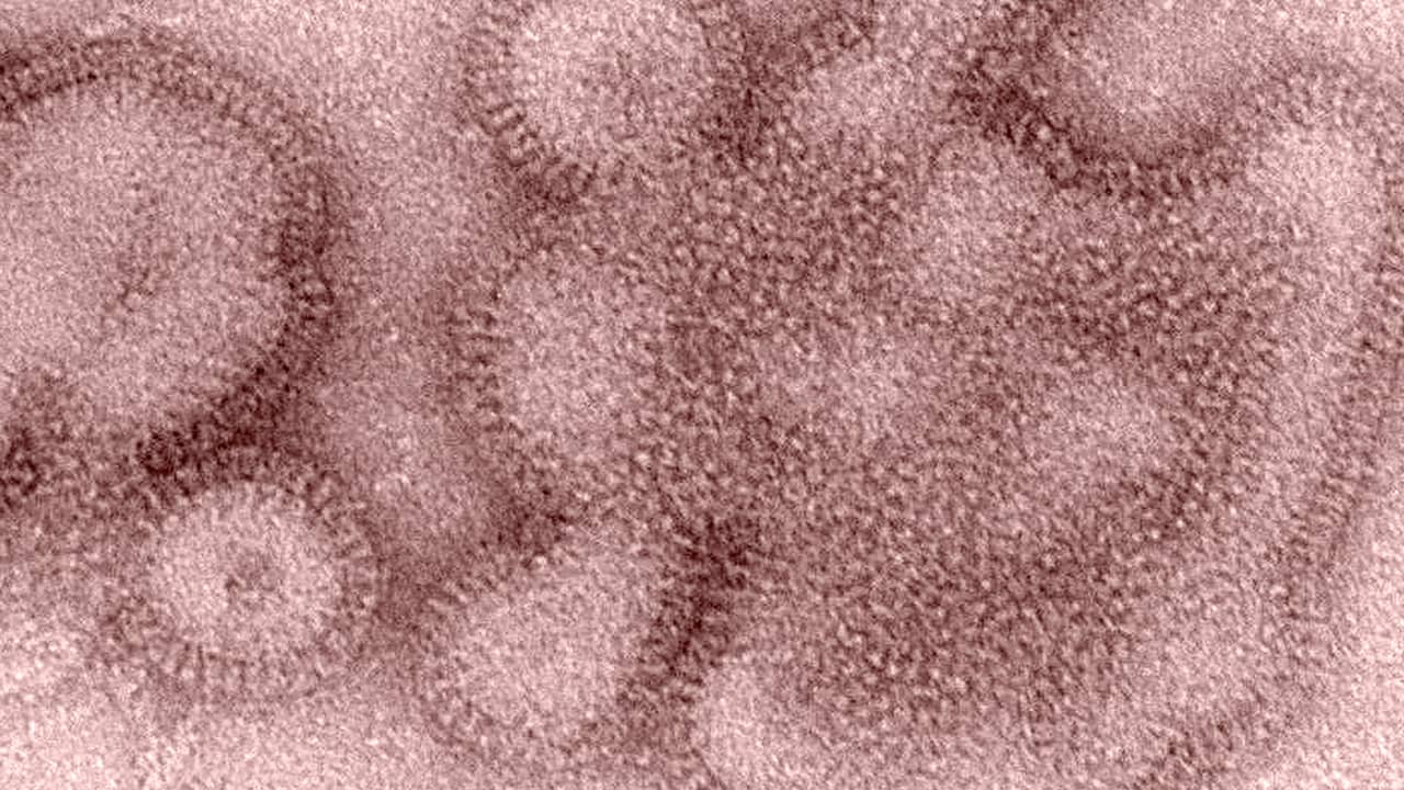 Photo of H3N2 influenza virions