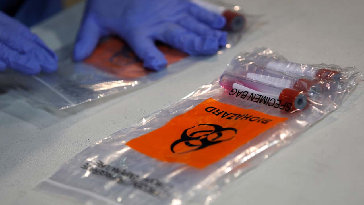 Photo of a nasal swab