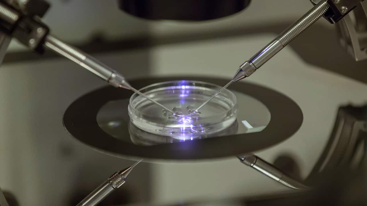 Photo of vitro fertilization