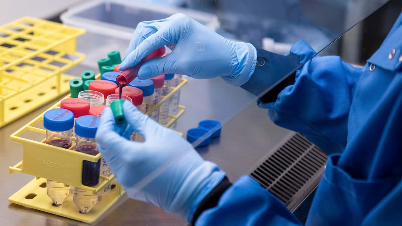 Image of vaccine blood samples at Oxford University