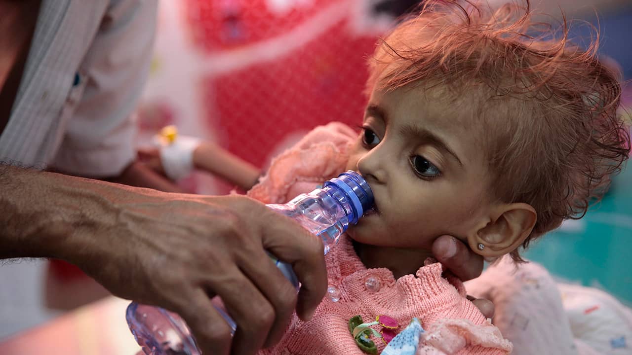 Photo of a hungry Yemeni child being fed.
