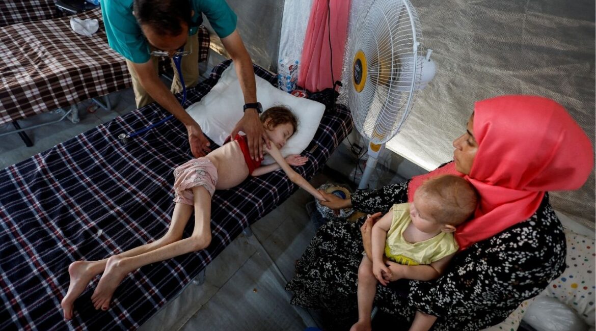 A doctor checks Jana Ayad, a malnourished Palestinian girl, as she receives treatment at the International Medical Corps field hospital, amid the Israel-Hamas conflict, in Deir Al-Balah in the southern Gaza Strip, June 22, 2024. (Reuters File)