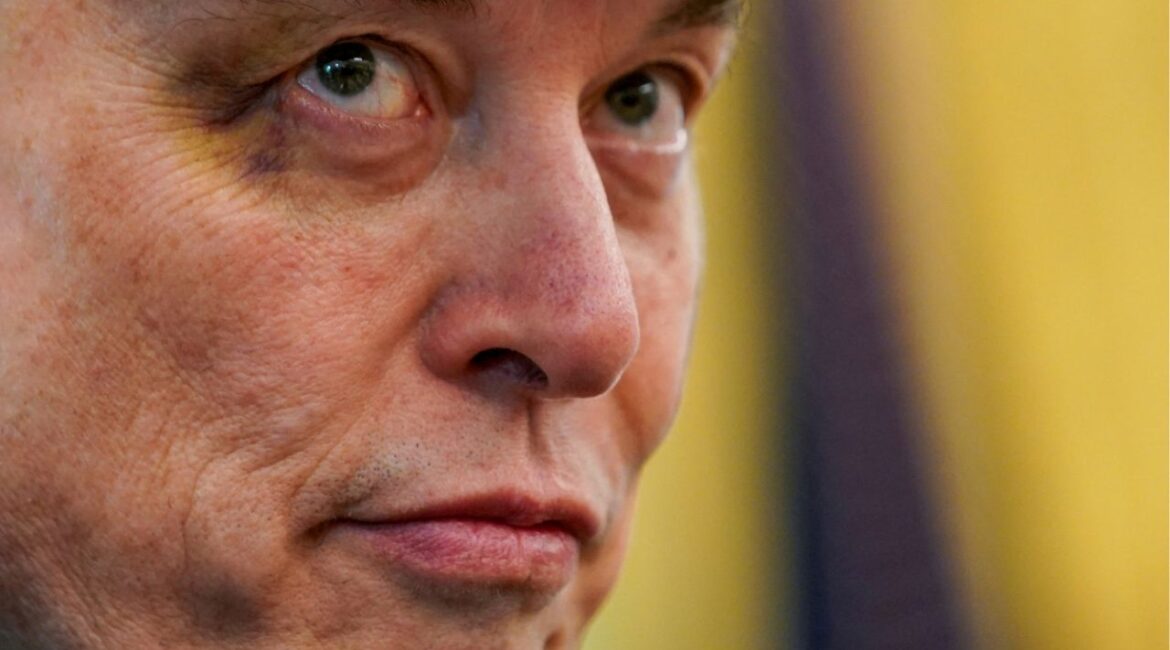 Elon Musk is seen with a bruised eye that Musk claimed he received at the hands of his son, X Æ A-12, as he attends a press conference with U.S. President Donald Trump in the Oval Office at the White House in Washington, D.C., U.S., May 30, 2025. (Reuters File)