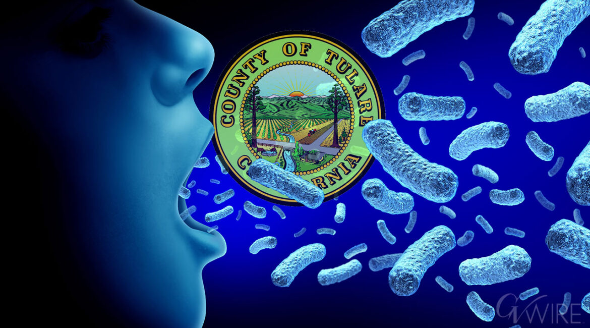 Tulare County experiencing an increase of whooping cough cases