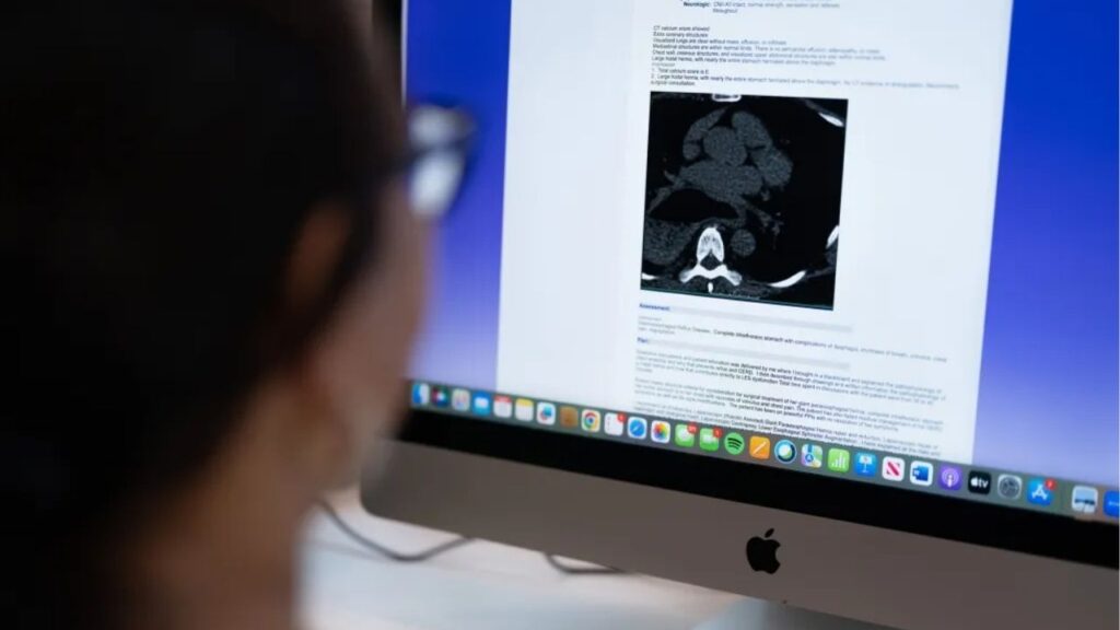Mary Kuhn looks at a CT scan and explanation of her condition at her home in Lafayette on Oct. 11, 2025. Kuhn had urgent surgery delayed and denied by Blue Shield of California for over half a year before finally getting it approved in June of 2025. Photo by Jungho Kim for CalMatters