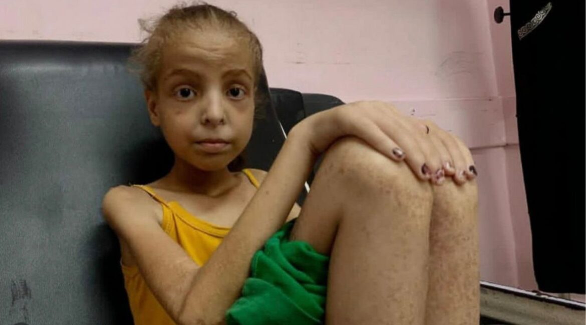 In an image provided by her family, Hoda Abu al-Naja, 12, in a hospital and suffering from malnutrition in July 2025. After Israel sealed Gaza’s borders, Hoda who suffered from celiac disease, spent months seeking the food and care she needed to combat malnutrition. (Abu al-Naja family via The New York Times)