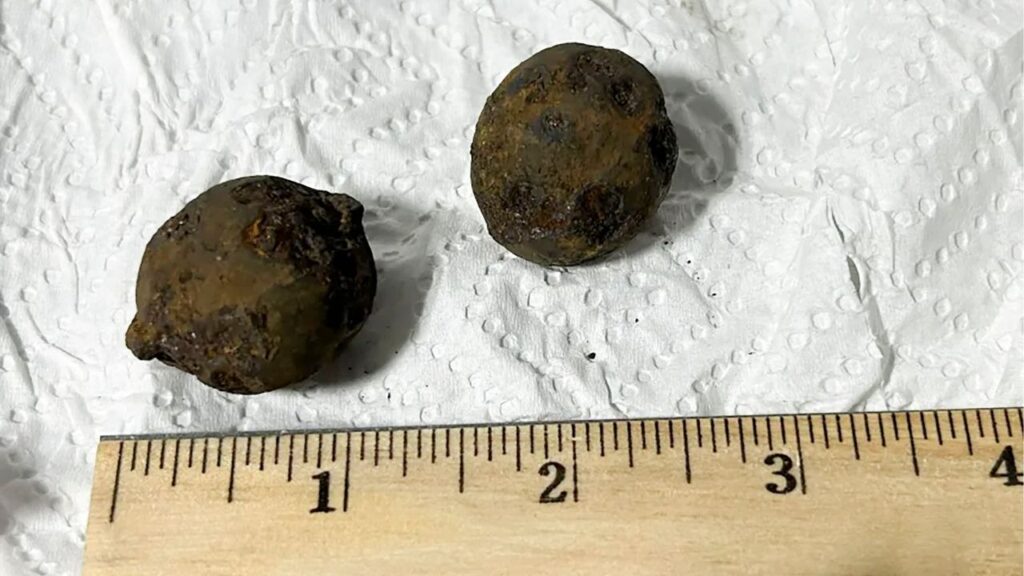 An undated photo provided by the Transportation Security Administration shows Civil War-era relics that were found at Alabama’s Gulf Shores International Airport. A Transportation Security Administration officer found pieces of Civil War history in checked luggage on an X-ray machine; the stolen relics ranged in size from grapefruit to “cherry-sized.”